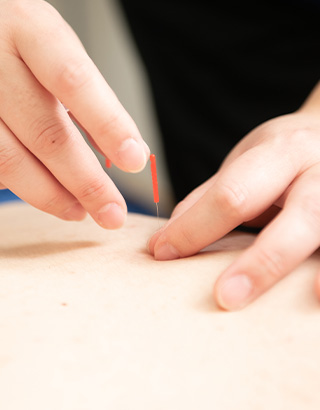 鍼灸